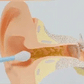 Auralis – Smart Ear Cleaning Device with Advanced Technology