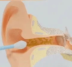 Auralis – Smart Ear Cleaning Device with Advanced Technology