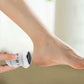 SmoothStep – Effortless Callus & Cracked Heel Removal