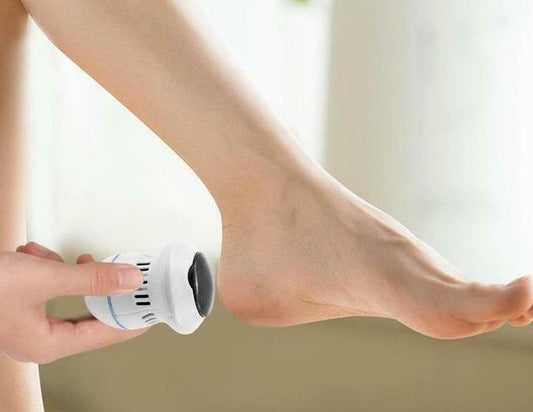SmoothStep – Effortless Callus & Cracked Heel Removal
